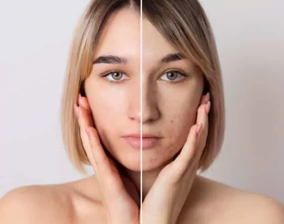 Treatment of skin diseases in Switzerland