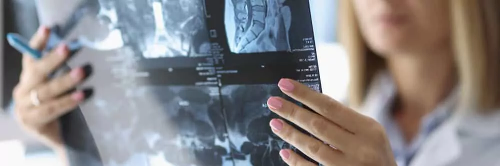 closeup professional female doctor analyze x ray patients back smart medical worker